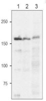 Fd-GOGAT | Ferredoxin-dependent Glutamate synthase in the group Antibodies Plant/Algal / Nitrogen Metabolism at Agrisera AB (Antibodies for research) (AS20 4428)